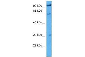 Image no. 2 for anti-Insulin-Like Growth Factor 2 mRNA Binding Protein 1 (IGF2BP1) (N-Term) antibody (ABIN2778994)
