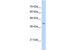 anti-ST6 (Alpha-N-Acetyl-Neuraminyl-2,3-beta-Galactosyl-1,3)-N-Acetylgalactosaminide alpha-2,6-Sialyltransferase 6 (ST6GALNAC6) (C-Term) antibody