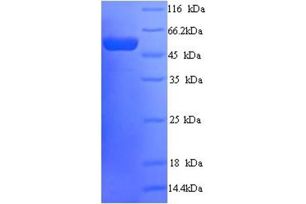 Peter Pan Homolog (PPAN) (AA 1-473), (full length) protein (His tag)