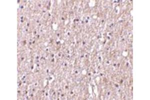 Image no. 1 for anti-Tumor Necrosis Factor (Ligand) Superfamily, Member 12 (TNFSF12) antibody (ABIN501094)