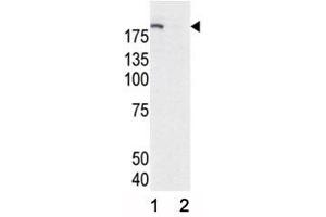Image no. 1 for anti-Epidermal Growth Factor Receptor (EGFR) (pTyr1172) antibody (ABIN3030845)