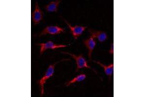 Image no. 2 for anti-ES cell expressed Ras (ERAS) (N-Term) antibody (ABIN356980)
