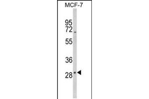 Image no. 2 for anti-Deiodinase, Iodothyronine, Type II (DIO2) (AA 165-191) antibody (ABIN5531011)