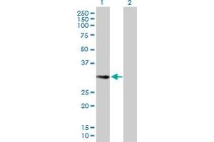 Image no. 1 for anti-Ets Homologous Factor (EHF) (AA 1-300) antibody (ABIN525699)