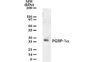 Image no. 1 for anti-Peptidoglycan Recognition Protein 3 (PGLYRP3) (AA 178-193) antibody (ABIN221181)