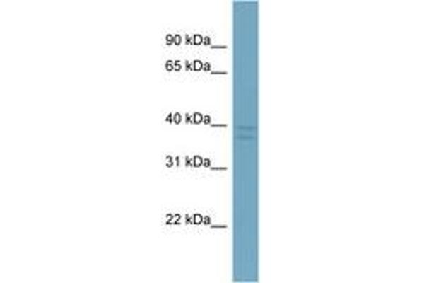 anti-Chromosome X Open Reading Frame 66 (CXorf66) (AA 107-156) antibody