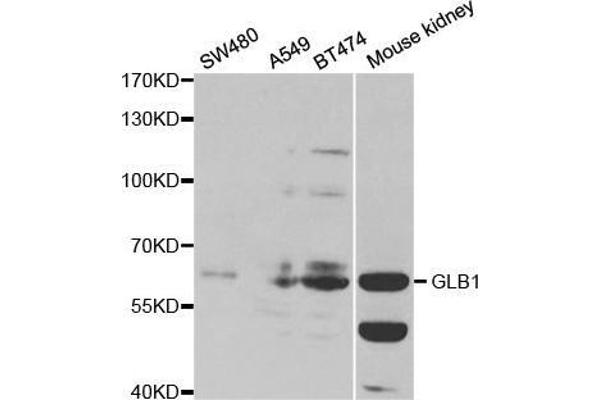 GLB1 Antikörper  (AA 1-270)