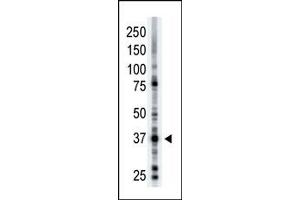 Image no. 1 for anti-ADP-Ribosyltransferase 1 (ART1) (N-Term) antibody (ABIN357661)