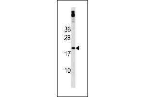Image no. 1 for anti-Zinc Finger Protein 740 (ZNF740) (AA 37-65), (N-Term) antibody (ABIN1882034)