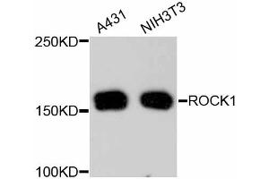 Image no. 2 for anti-rho-Associated, Coiled-Coil Containing Protein Kinase 1 (ROCK1) antibody (ABIN4905028)