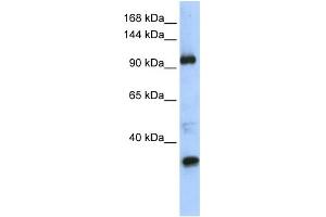Image no. 1 for anti-Terminal Uridylyl Transferase 1, U6 SnRNA-Specific (TUT1) (Middle Region) antibody (ABIN2781191)