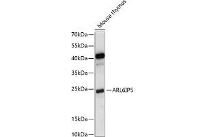 ARL6IP5 抗体  (C-Term)