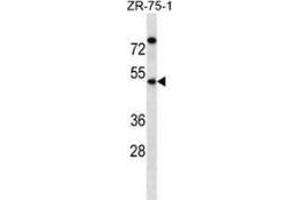 anti-Essential Meiotic Endonuclease 1 Homolog 2 (EME2) (AA 248-278), (C-Term) antibody
