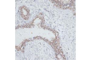Image no. 3 for anti-Nucleolar Protein 3 (Apoptosis Repressor with CARD Domain) (NOL3) antibody (ABIN6144704)