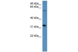 Image no. 1 for anti-Homeobox D13 (HOXD13) (C-Term) antibody (ABIN2777525)