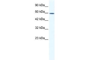 anti-DEAD (Asp-Glu-Ala-Asp) Box Polypeptide 5 (DDX5) (C-Term) antibody
