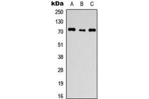 Western blot analysis of ANO1 expression in HEK293T (A), H9C2 (B), HeLa (C) whole cell lysates.