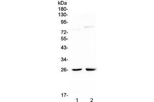 Western blot testing of 1) rat kidney and 2) mouse kidney lysate with NMU antibody at 0.