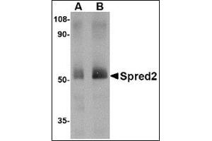 Image no. 1 for anti-Sprouty-Related, EVH1 Domain Containing 2 (SPRED2) (Center) antibody (ABIN500800)