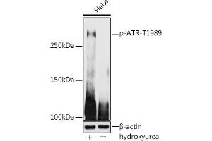 ATR antibody  (pThr1989)