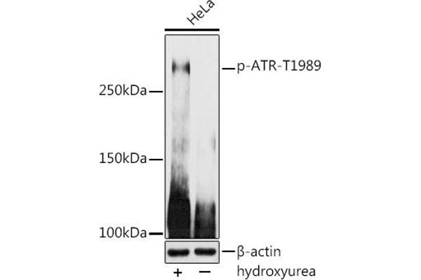 ATR anticorps  (pThr1989)