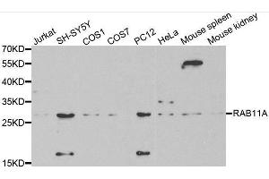 Image no. 1 for anti-RAB11A, Member RAS Oncogene Family (RAB11A) antibody (ABIN3021608)