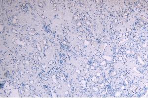Image no. 3 for anti-V-Myb Myeloblastosis Viral Oncogene Homolog (Avian) (MYB) (AA 281-294) antibody (ABIN190759)