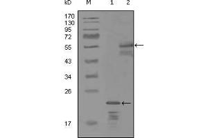 Image no. 2 for anti-Receptor Tyrosine-Protein Kinase ErbB-3 (ERBB3) (AA 1175-1275) antibody (ABIN969112)