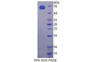 Image no. 1 for Choline Kinase alpha (CHKA) (AA 1-250) protein (His tag,GST tag) (ABIN6239602)