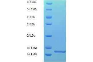 Luteinizing Hormone beta Polypeptide (LHB) (AA 21-141) protein (His tag)