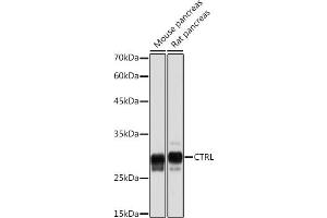 Chymotrypsin antibody