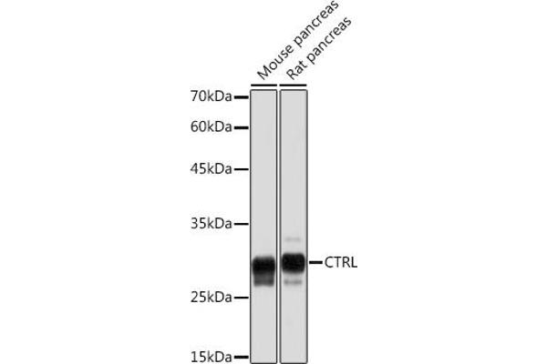 Chymotrypsin antibody