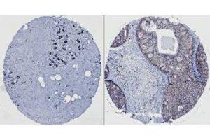 Image no. 3 for anti-Neural Precursor Cell Expressed, Developmentally Down-Regulated 9 (NEDD9) (AA 82-398) antibody (ABIN108572)