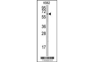 Western Blotting (WB) image for anti-Cytochrome P450, Family 1, Subfamily A, Polypeptide 1 (CYP1A1) antibody (ABIN2158432)
