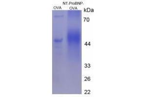 Image no. 3 for Pro-Brain Natriuretic Peptide (NT-ProBNP) (NT-ProBNP) (N-Term) peptide (Ovalbumin) (ABIN5666287)