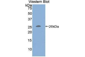 Image no. 1 for anti-CD79b Molecule, Immunoglobulin-Associated beta (CD79B) (AA 37-226) antibody (ABIN1859292)
