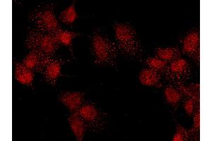 Image no. 1 for anti-Pre-B-Cell Leukemia Homeobox Protein 1 (PBX1) (C-Term) antibody (ABIN6925281)