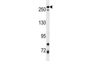 Image no. 2 for anti-Leucine-Rich Repeat Kinase 2 (LRRK2) (AA 878-909) antibody (ABIN3031607)