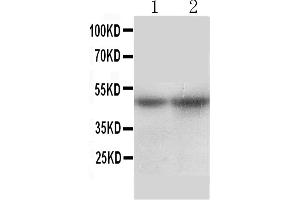 Image no. 3 for anti-Solute Carrier Family 10 (Sodium/bile Acid Cotransporter Family), Member 1 (SLC10A1) (AA 141-154), (Middle Region) antibody (ABIN3044254)
