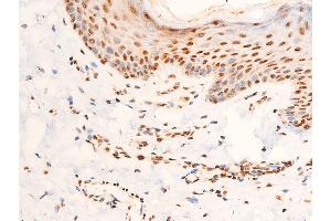 ABIN6267306 at 1/100 staining human skin tissue sections by IHC-P.