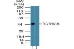 Image no. 2 for anti-Toll-Like Receptor Adaptor Molecule 2 (TICAM2) (AA 150-200) antibody (ABIN960372)
