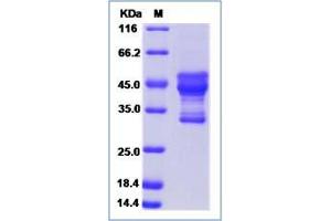 Image no. 1 for ADP-Ribosylation-Like Factor 6 Interacting Protein 6 (ARL6IP6) (AA 1-110) protein (Fc Tag) (ABIN2006298)