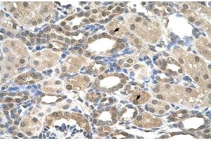 Image no. 4 for anti-Presenilin 2 (Alzheimer Disease 4) (PSEN2) (N-Term) antibody (ABIN2781802)