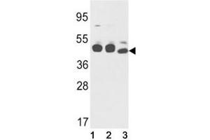 Image no. 7 for anti-Keratin 18 (KRT18) (AA 401-430) antibody (ABIN3031537)