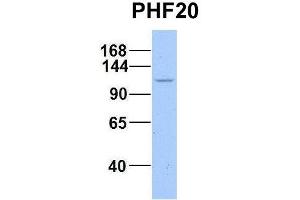 Image no. 2 for anti-PHD Finger Protein 20 (PHF20) (C-Term) antibody (ABIN2774935)