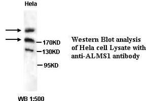 Image no. 1 for anti-Alstrom Syndrome 1 (ALMS1) antibody (ABIN6583515)