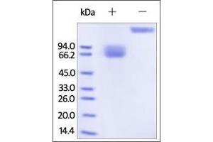 Human Growth Hormone R, Fc Tag on SDS-PAGE under reducing (R) and no-reducing (NR) conditions.