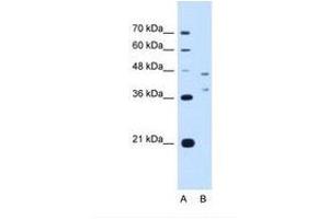 Image no. 1 for anti-Ecotropic Viral Integration Site 2B (EVI2B) (AA 251-300) antibody (ABIN321145)
