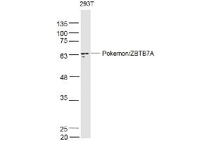 Image no. 3 for anti-Zinc Finger and BTB Domain Containing 7A (ZBTB7A) (AA 151-250) antibody (ABIN729448)