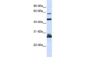 Image no. 1 for anti-Pescadillo Ribosomal Biogenesis Factor 1 (PES1) (C-Term) antibody (ABIN2786001)
